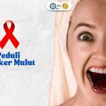 Penyakit Kanker Mulut Sangat Perlu Untuk Waspadai, Yuk Simak